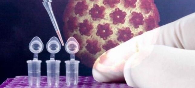 Diagnostyka HPV za pomocą testu digene